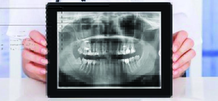Revolutionizing Dentistry: A Comprehensive Look at the Dental X-Ray and Dental Imaging